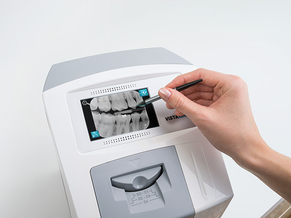 Radiologia digitale ai fosfori | Studio Caberlotto Dentisti