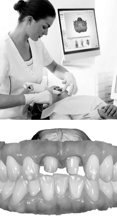 Studio-dentistico-Caberlotto-metodo-fase01